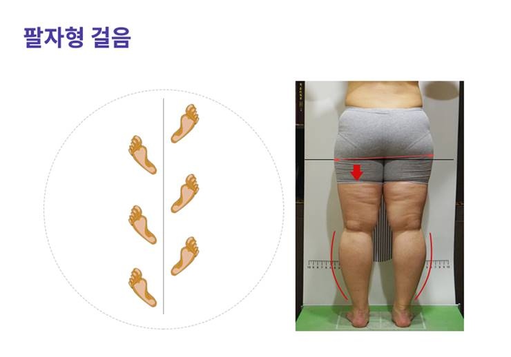 걸음걸이에 따라 하체라인이 달라진다?