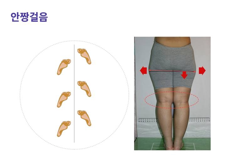 걸음걸이에 따라 하체라인이 달라진다?