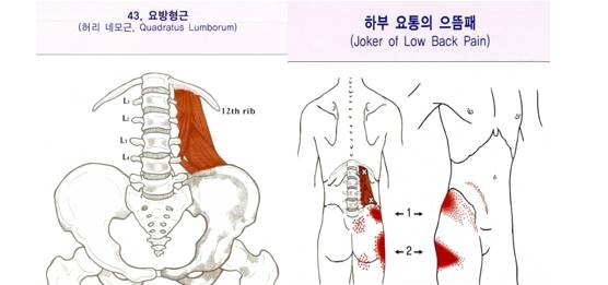 허리 아플때 풀어줘야 하는 근육 '요방형근'!