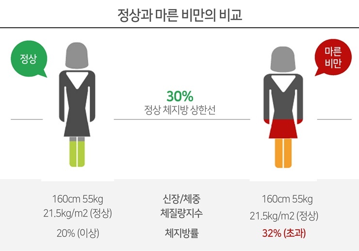 날씬한데 배만 볼록한 '마른비만'?