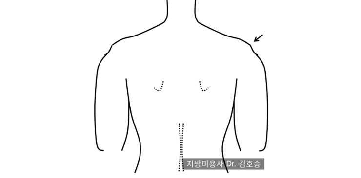 당신의 팔, 날씬하게 만들어주는 운동 팁!