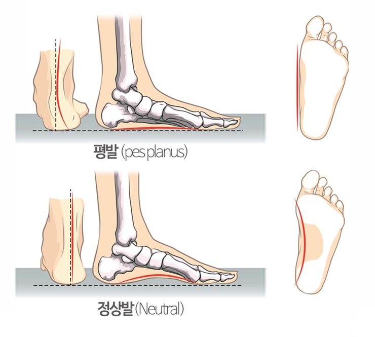 종아리 알, 잘 생기고 잘 붓는다면?